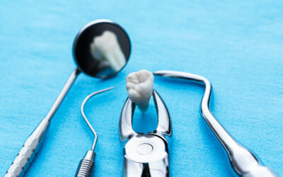 5 Tips For A Stress-Free Tooth Extraction